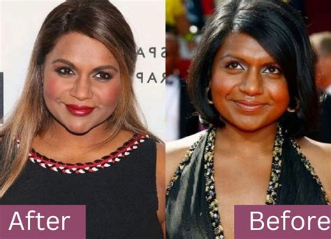 mindy kaling plastic surgery|Mindy Kaling’s plastic surgery – questionable complexion ...